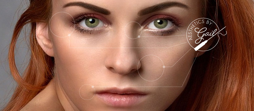 non surgical facelift Bolton